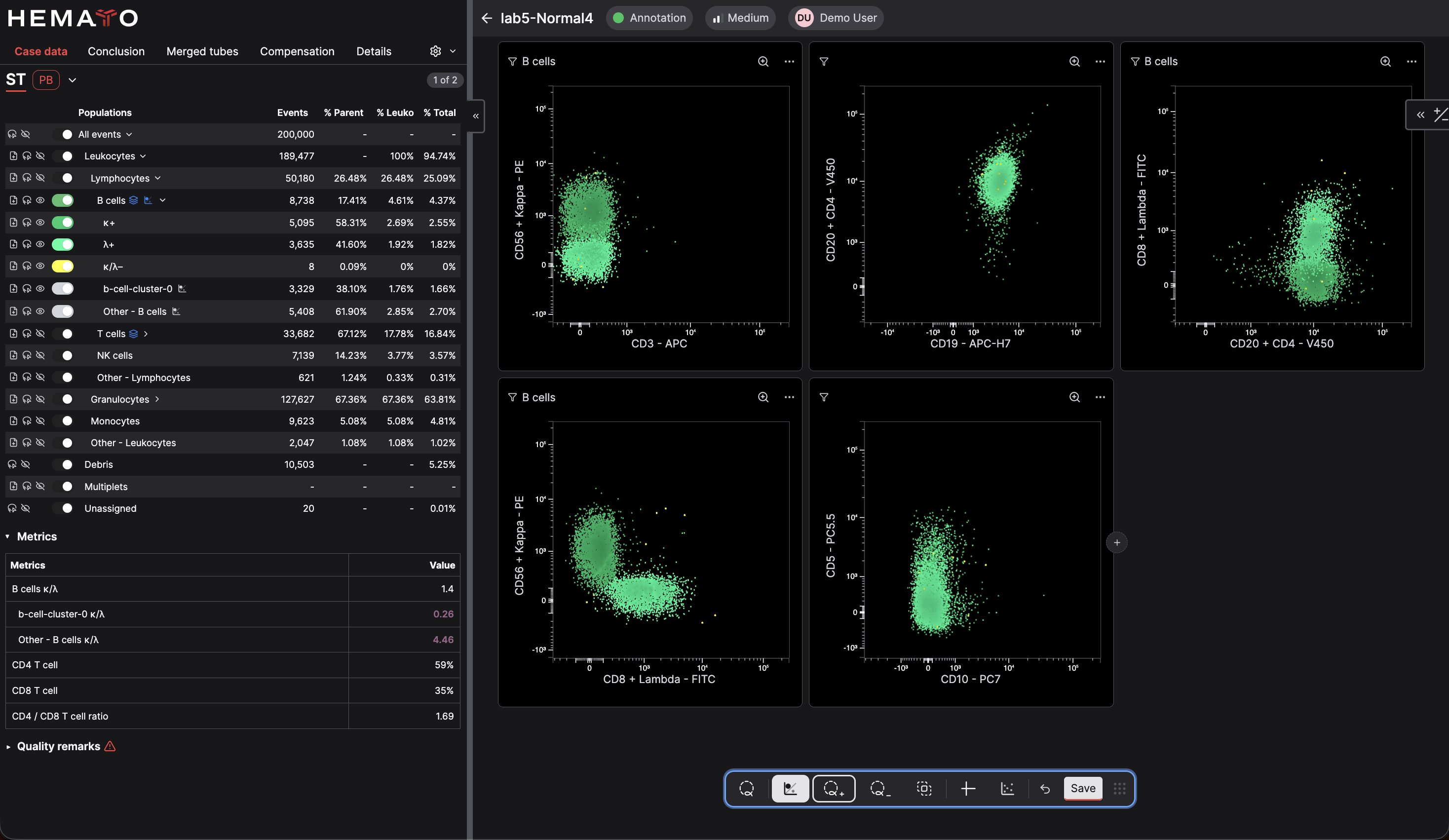 CellStudio analysis showing kappa and lambda clonality cytograms for several B-cell populations