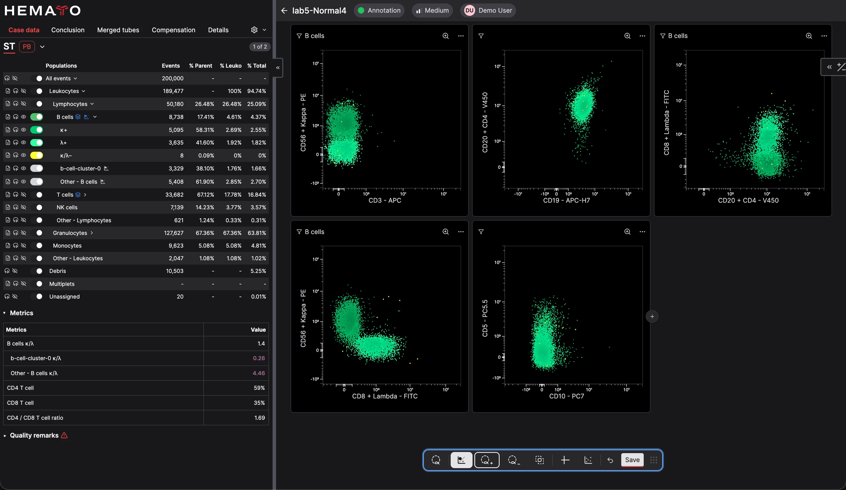 CellStudio analysis showing kappa and lambda clonality cytograms for several B-cell populations