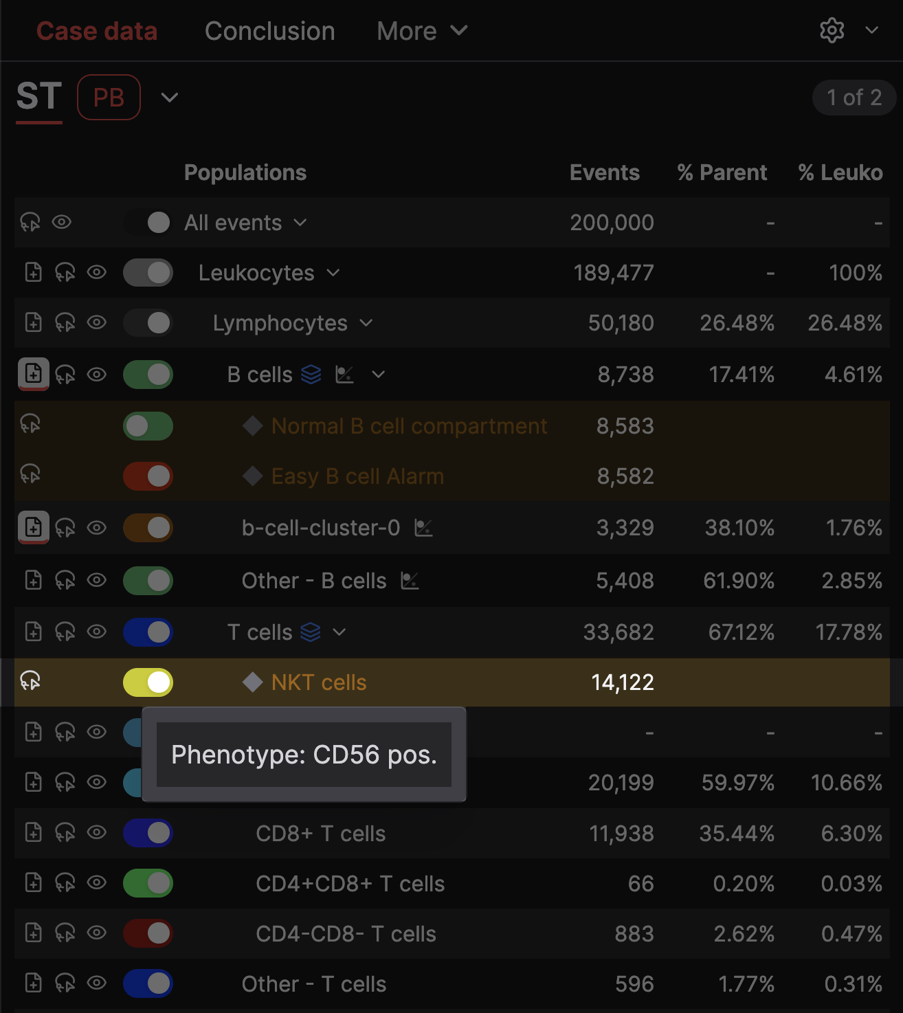 Cell population tree highlighting NKT cells identified by a CD56-positive phenotype